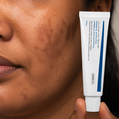 TX Cream Dark Spot Corrector